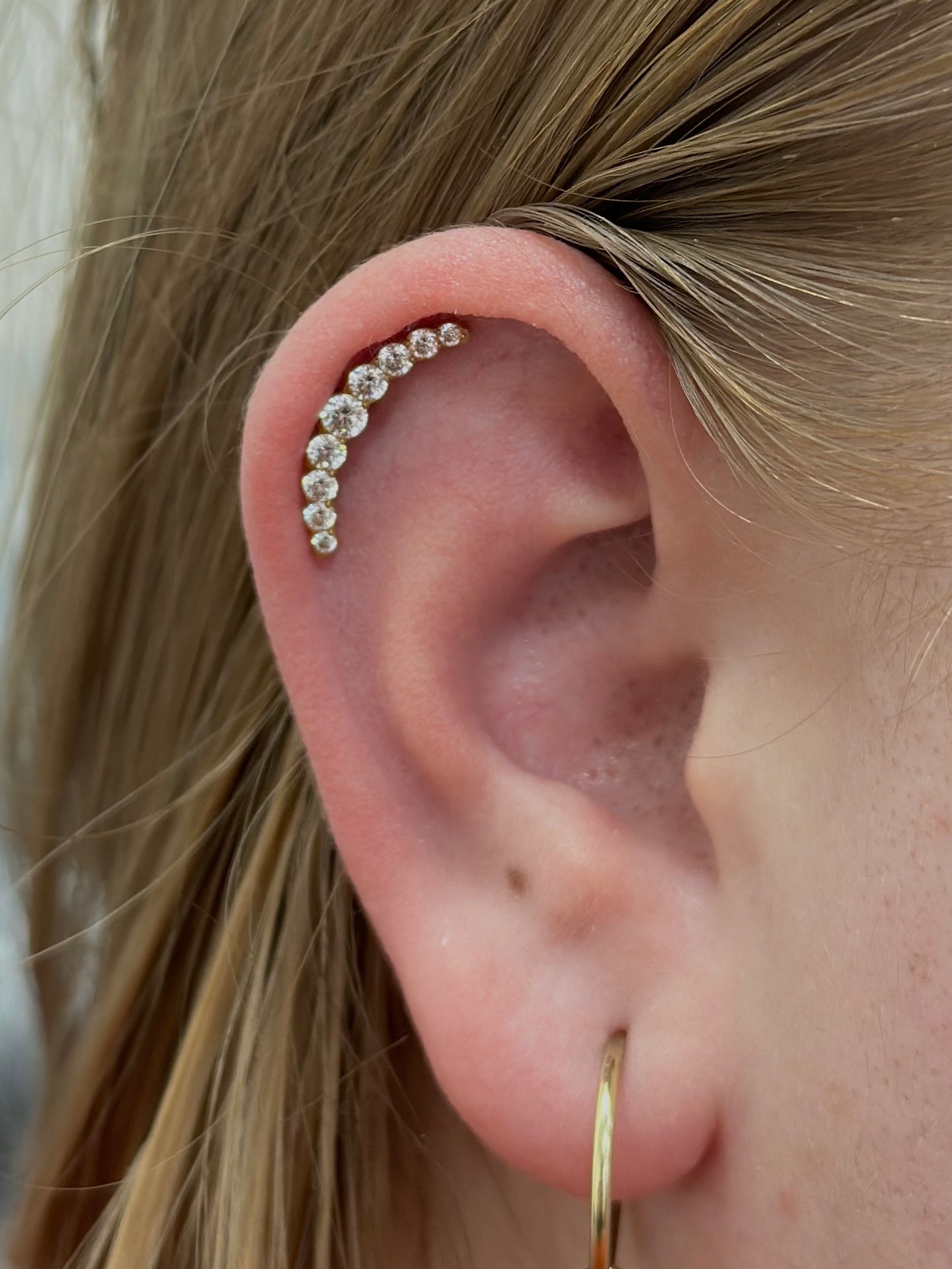 Titanium Luxury Crown