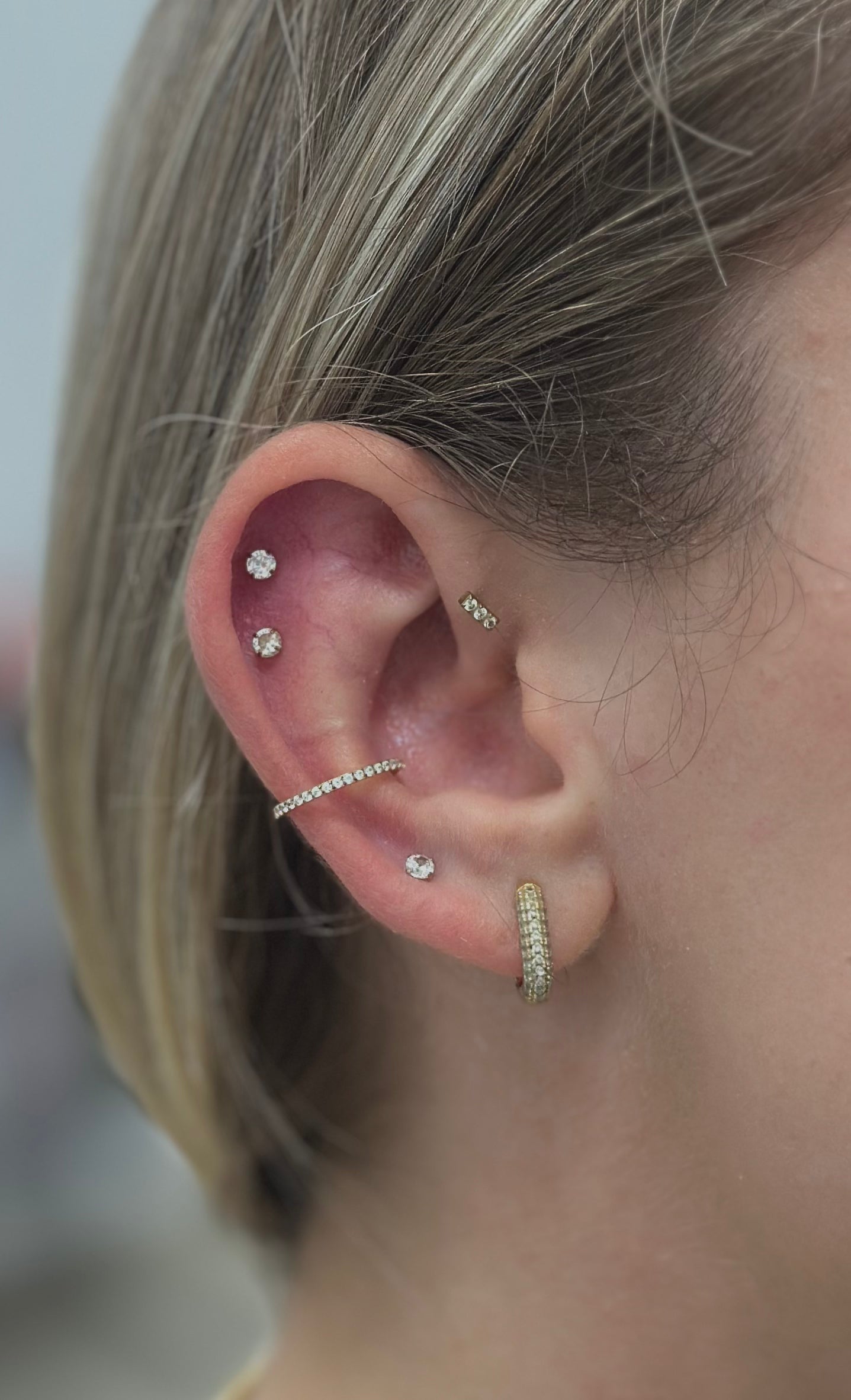 Titanium Simple Zircona